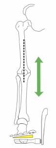 Aligned Lower Leg